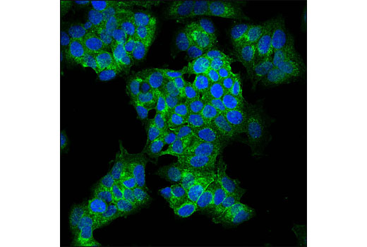 Immunofluorescence Image 1: Notch1 (D6F11) XP® Rabbit mAb