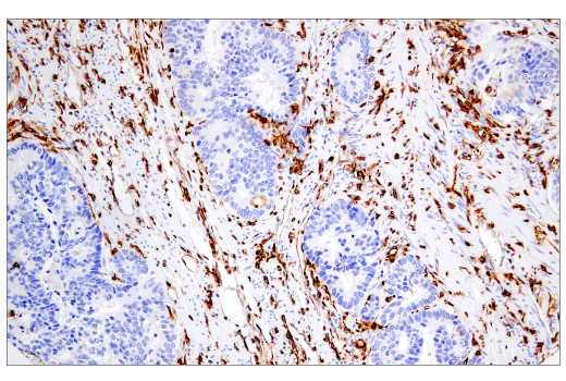 Mhc Class Ii Lgii Mouse Mab Bsa And Azide Free Cell