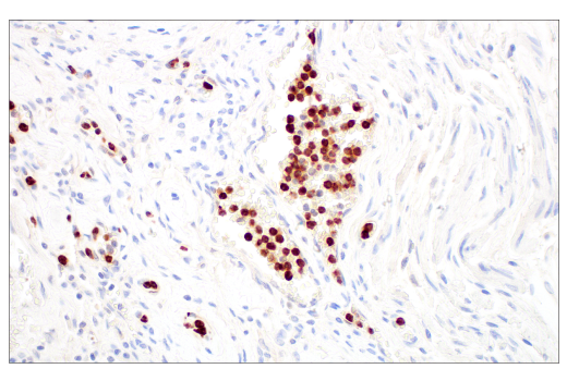 Immunohistochemistry Image 2: LCN2 (D4M8L) Rabbit mAb