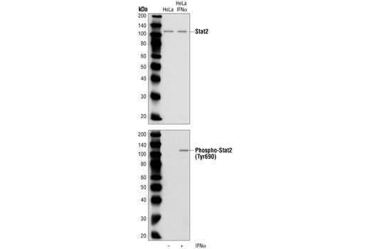 Western Blotting Image 1: Phospho-Stat2 (Tyr690) Antibody