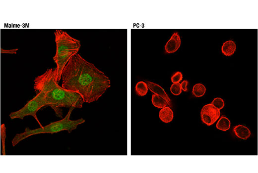 Immunofluorescence Image 1: Stat5 (D3N2B) Rabbit mAb (BSA and Azide Free)