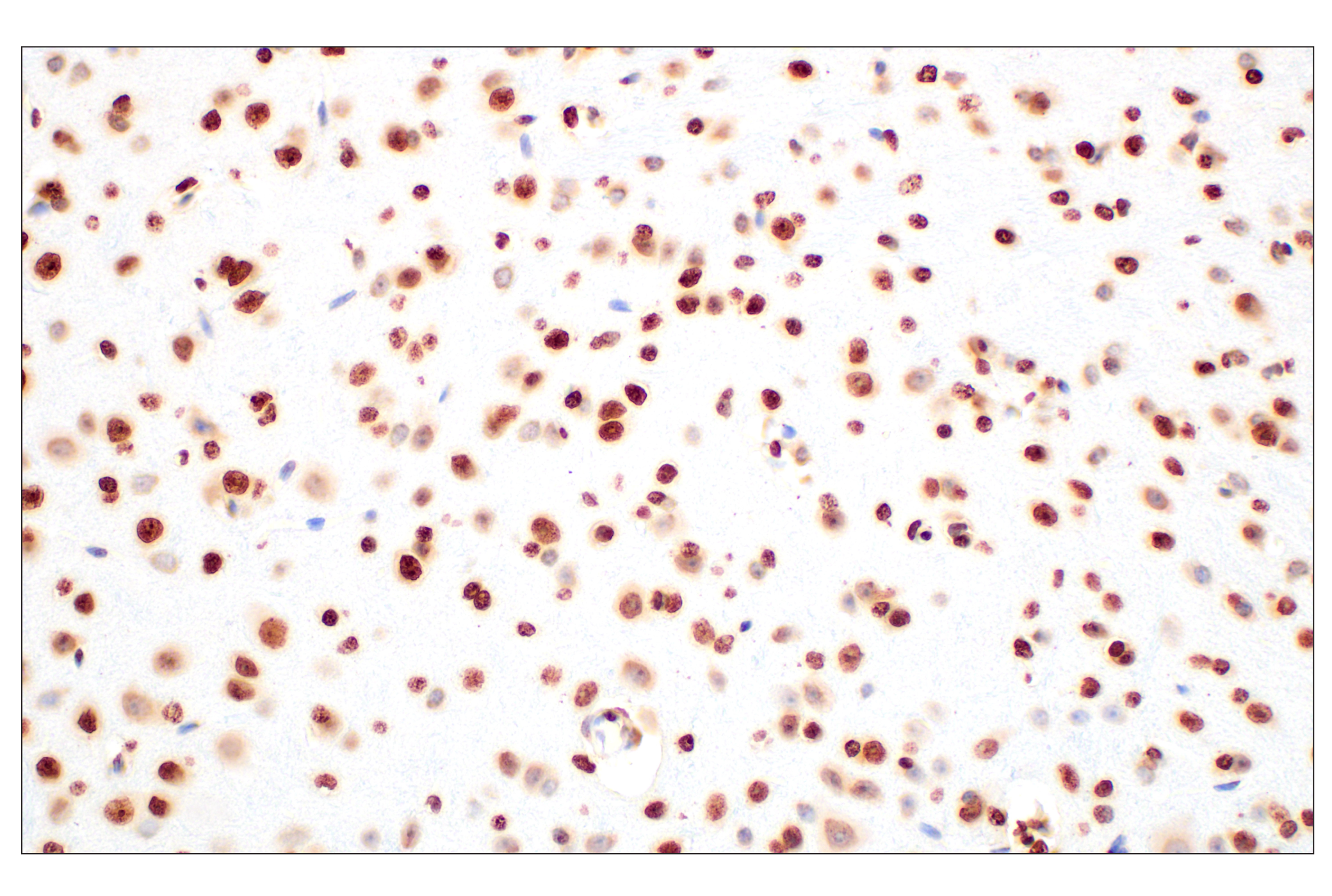 Immunohistochemistry Image 4: Histone H3 (D1H2) XP® Rabbit mAb