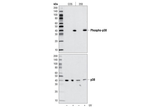  Image 15: Phospho-Tau (Ser214/T217) Signaling Antibody Sampler Kit