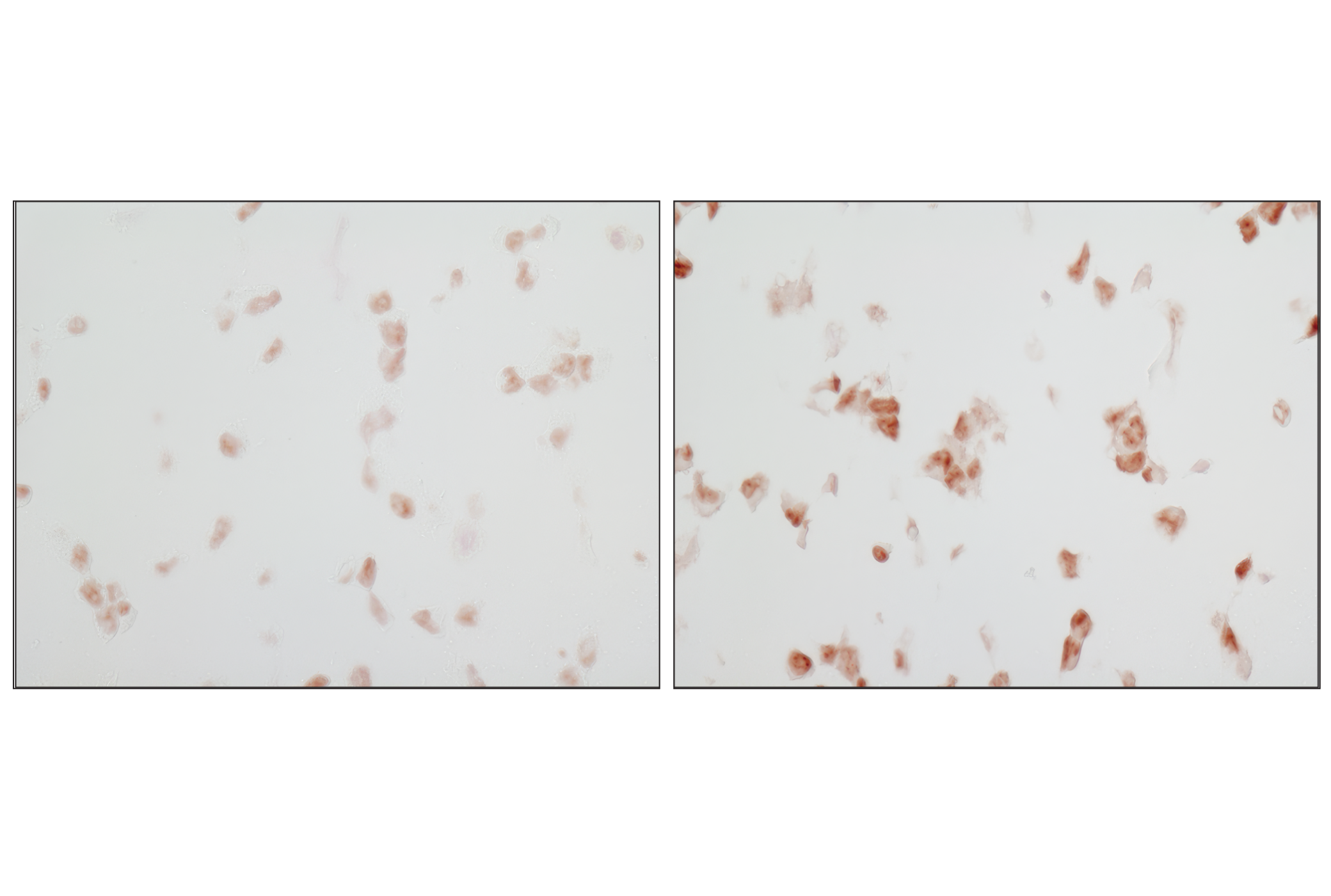  Image 36: Phospho-Tau (Ser214/T217) Signaling Antibody Sampler Kit
