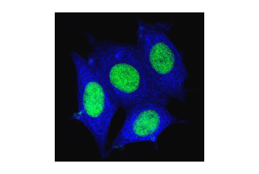Immunofluorescence Image 3: Pan-Keratin (C11) Mouse mAb (Alexa Fluor® 647 Conjugate)