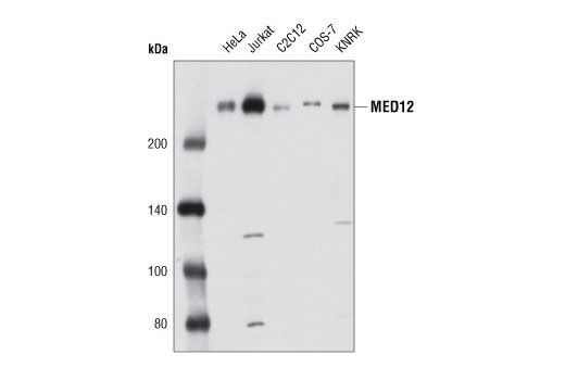 Western Blotting Image 1: MED12 Antibody