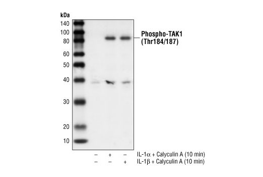Western Blotting Image 1: Phospho-TAK1 (Thr184/187) Antibody