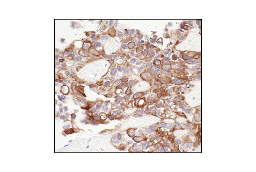 Immunohistochemistry Image 1: Pan-Keratin (C11) Mouse mAb