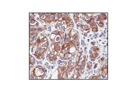  Image 21: Cytoskeletal Marker Antibody Sampler Kit