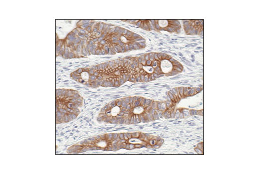 Immunohistochemistry Image 3: Pan-Keratin (C11) Mouse mAb