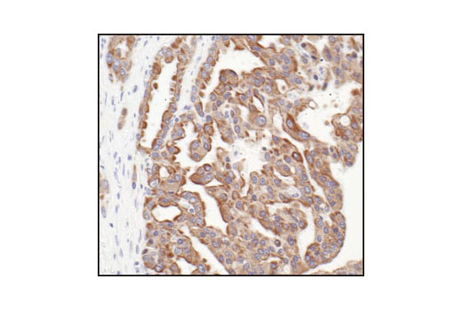  Image 31: Cytoskeletal Marker Antibody Sampler Kit