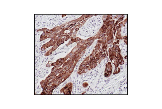 Immunohistochemistry Image 5: Pan-Keratin (C11) Mouse mAb