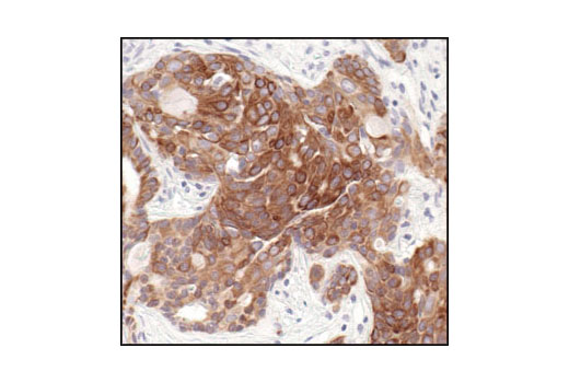 Immunohistochemistry Image 3: Keratin 8/18 (C51) Mouse mAb