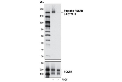  Image 9: PDGF Receptor β Antibody Sampler Kit