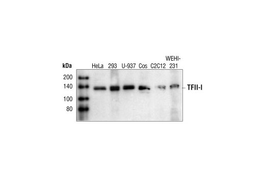 Western Blotting Image 1: TFII-I Antibody