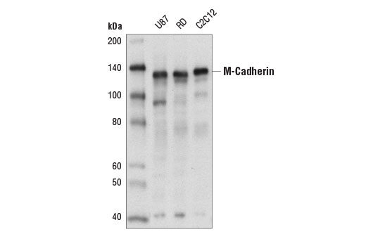 Western Blotting Image 1: M-Cadherin Antibody