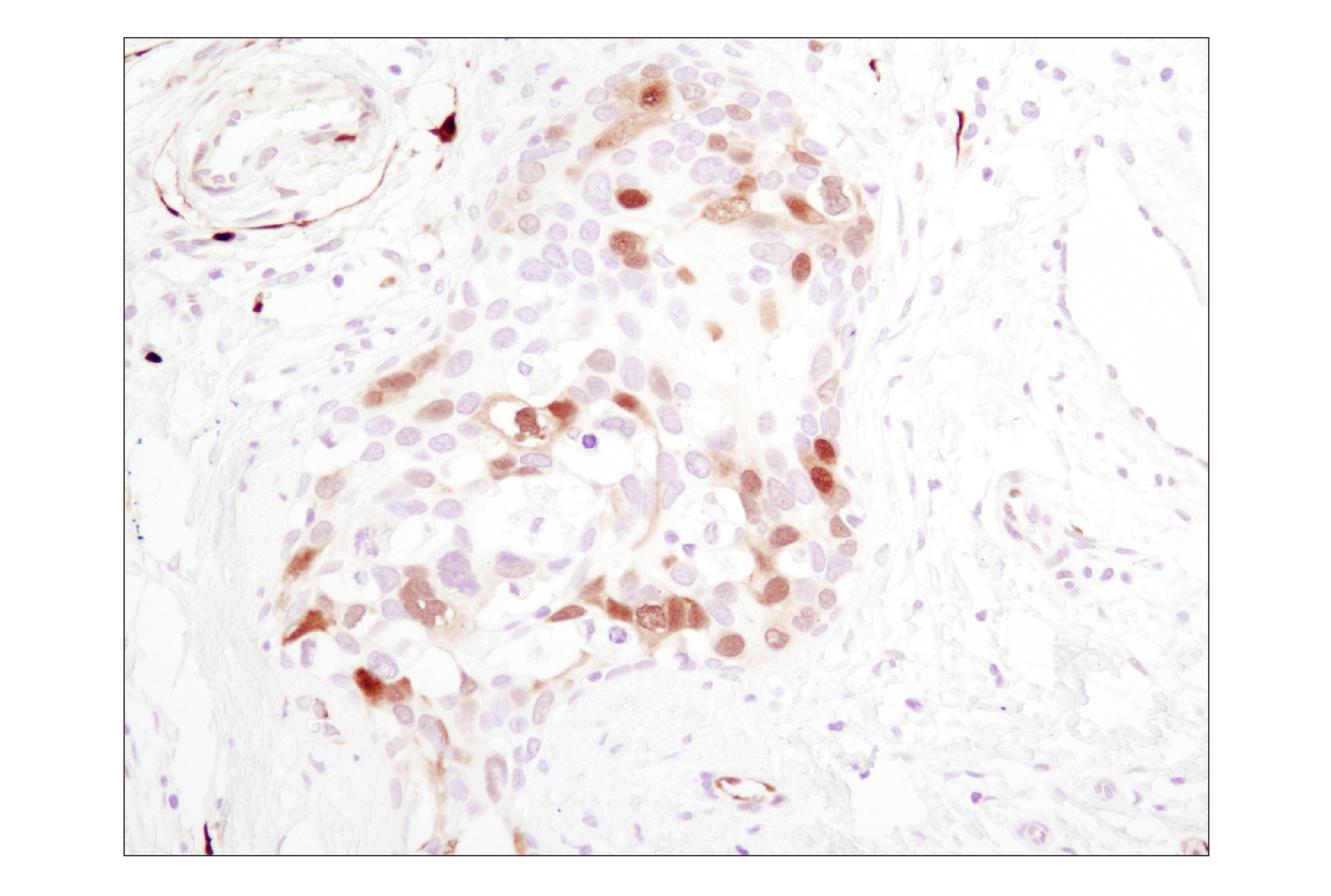 Immunohistochemistry Image 1: Phospho-p44/42 MAPK (Erk1/2) (Thr202/Tyr204) (D13.14.4E) XP® Rabbit mAb (BSA and Azide Free)