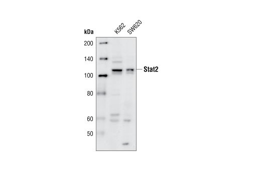 Western Blotting Image 1: Stat2 Antibody