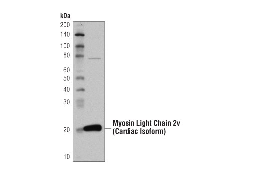 Western Blotting Image 3: Mouse Heart Tissue Control Extracts