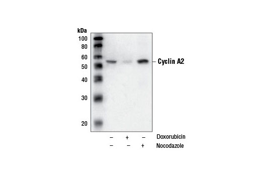  Image 9: Cell Cycle Regulation Antibody Sampler Kit II