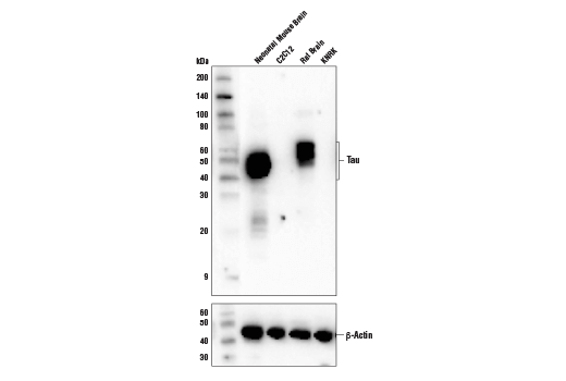  Image 25: Phospho-Tau (Ser214/T217) Signaling Antibody Sampler Kit