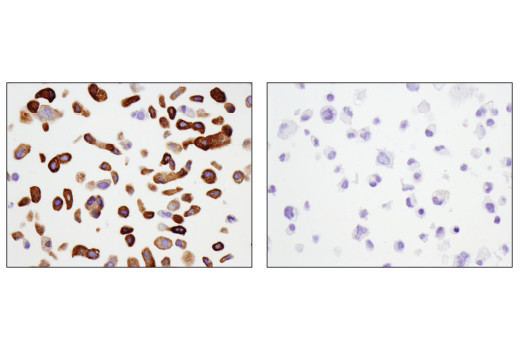  Image 40: Phospho-Tau (Ser214/T217) Signaling Antibody Sampler Kit