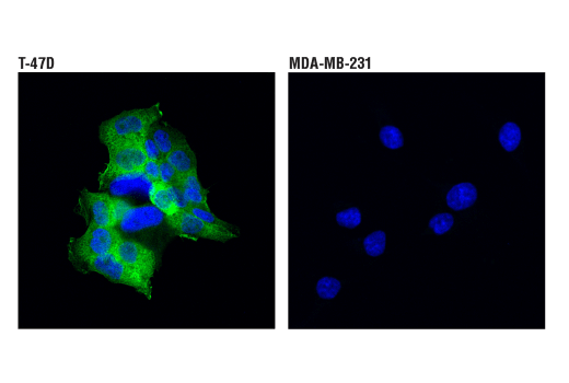  Image 50: Phospho-Tau (Ser214/T217) Signaling Antibody Sampler Kit