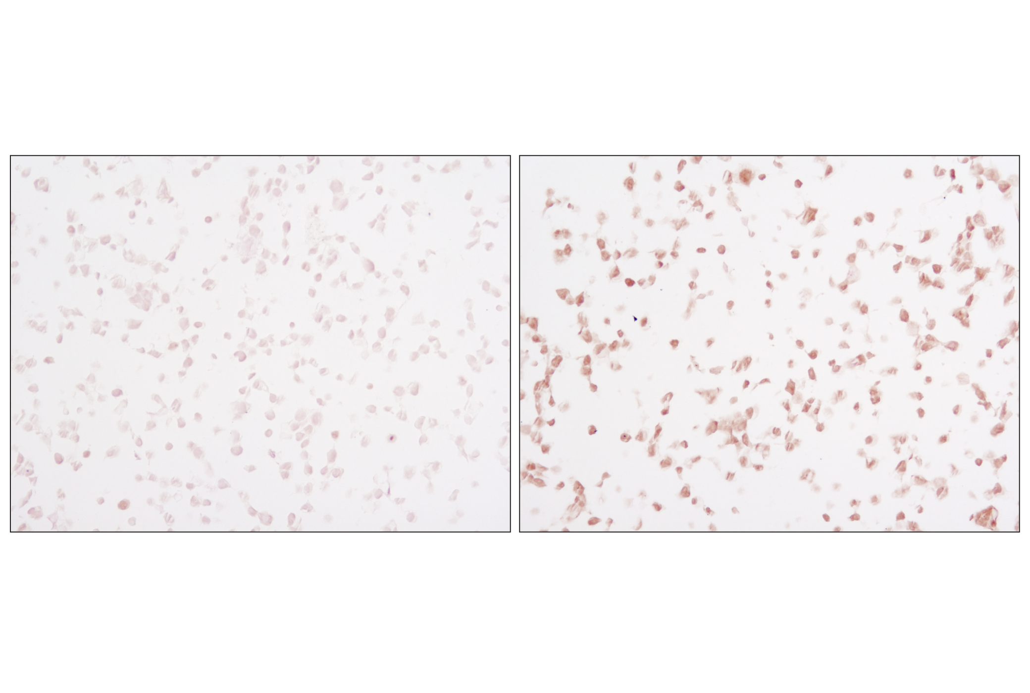  Image 33: Phospho-Tau (Ser214/T217) Signaling Antibody Sampler Kit