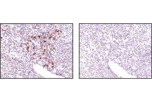 Immunohistochemistry Image 1: TRAF1 (45D3) Rabbit mAb