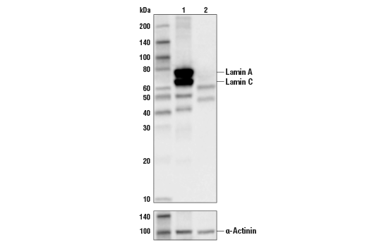  Image 6: Effector Caspases and Substrates Antibody Sampler Kit
