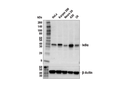  Image 21: NF-κB Pathway Antibody Sampler Kit II