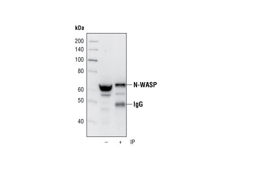 Immunoprecipitation Image 1: N-WASP (30D10) Rabbit mAb