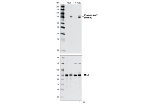 Western Blotting Image 1: Phospho-Mre11 (Ser676) Antibody