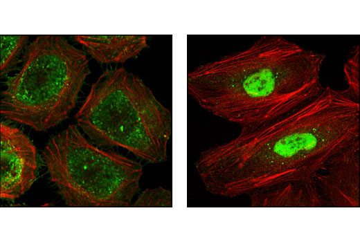 Immunofluorescence Image 1: HSP40 Antibody