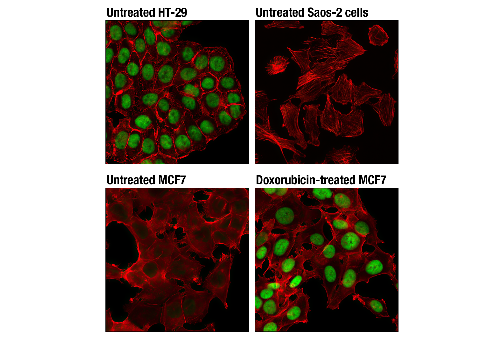 Immunofluorescence Image 1: p53 (DO-7) Mouse mAb