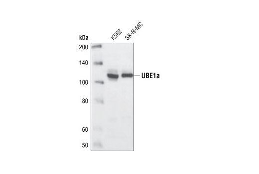  Image 3: Ubiquitin Activation (E1, E2 Enzymes) Antibody Sampler Kit