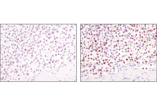 Immunohistochemistry Image 2: Nanog (1E6C4) Mouse mAb