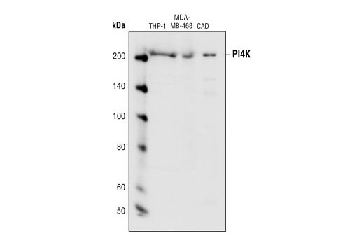 Western Blotting Image 1: PI4 Kinase Antibody