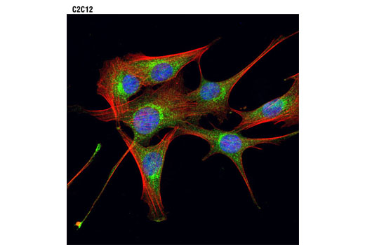 Immunofluorescence Image 1: PI4 Kinase Antibody