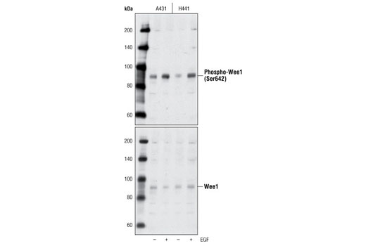  Image 10: Cell Cycle Regulation Antibody Sampler Kit II
