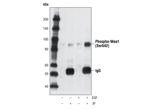 Immunoprecipitation Image 1: Phospho-Wee1 (Ser642) (D47G5) Rabbit mAb