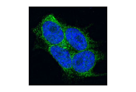 Immunofluorescence Image 1: STIM2 Antibody