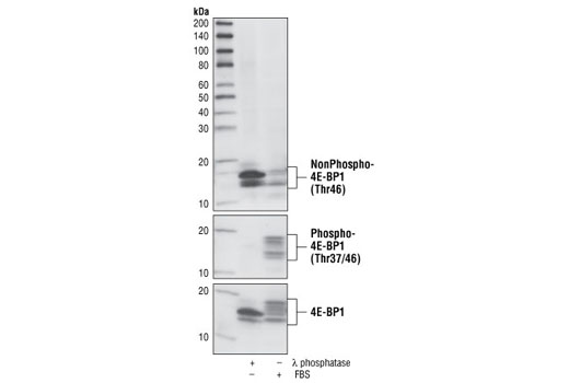  Image 5: 4E-BP Antibody Sampler Kit