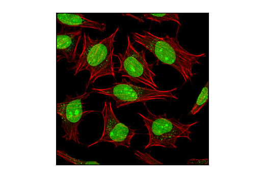 Immunofluorescence Image 3: SUMO-1 Antibody