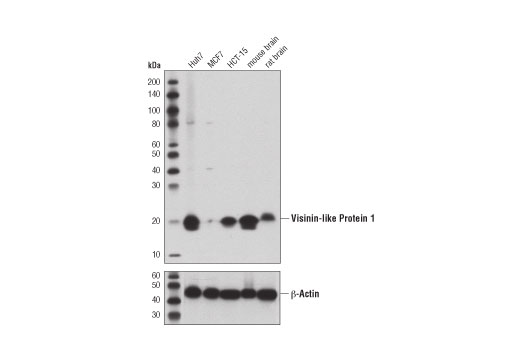 Western Blotting Image 1: Visinin-Like Protein 1 (D9L6L) Rabbit mAb