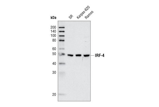 Western Blotting Image 2: IRF-4 (P173) Antibody