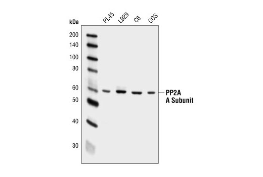 Western Blotting Image 1: PP2A A Subunit (4G7) Mouse mAb