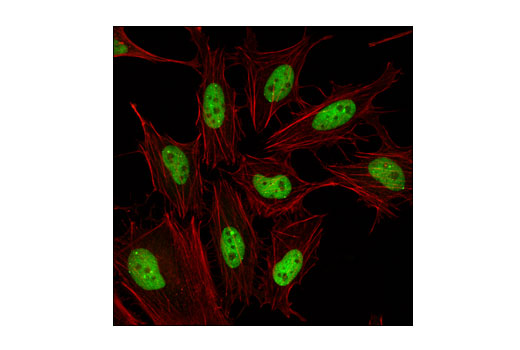 Immunofluorescence Image 1: SUMO-2/3 (18H8) Rabbit mAb