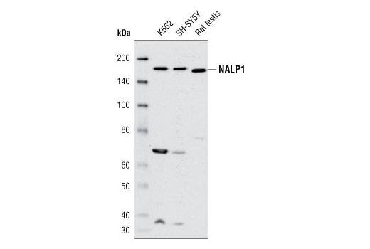 Western Blotting Image 1: NALP1 Antibody