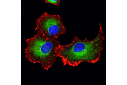  Image 13: ER and Golgi-Associated Marker Proteins Antibody Sampler Kit